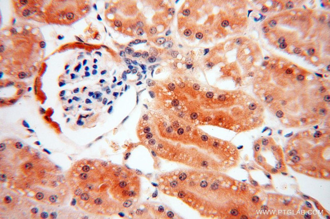 RABL2A Antibody in Immunohistochemistry (Paraffin) (IHC (P))