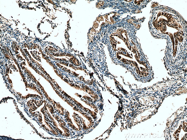 RABL2A Antibody in Immunohistochemistry (Paraffin) (IHC (P))