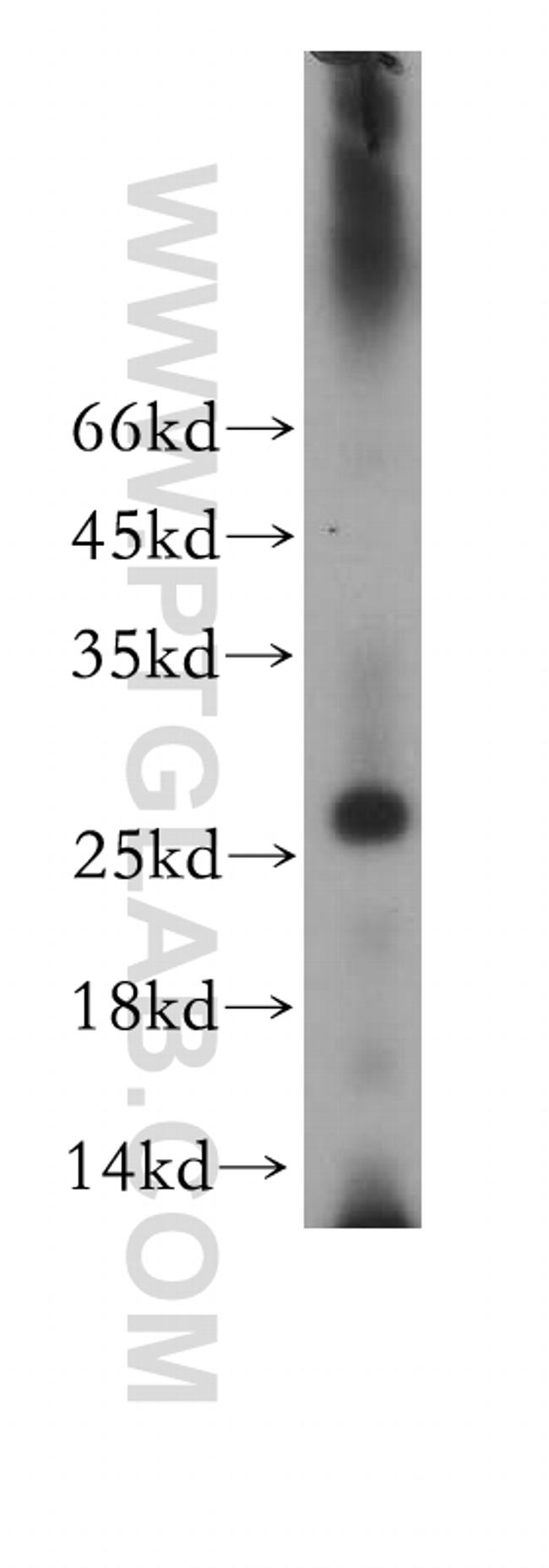 RABL2A Antibody in Western Blot (WB)