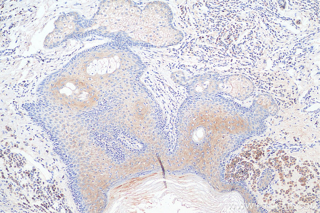 RAB27A Antibody in Immunohistochemistry (Paraffin) (IHC (P))