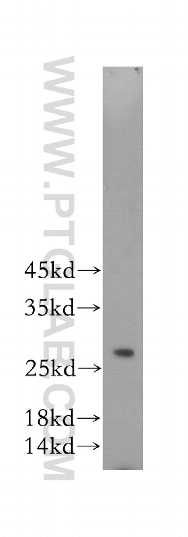 RAB27A Antibody in Western Blot (WB)