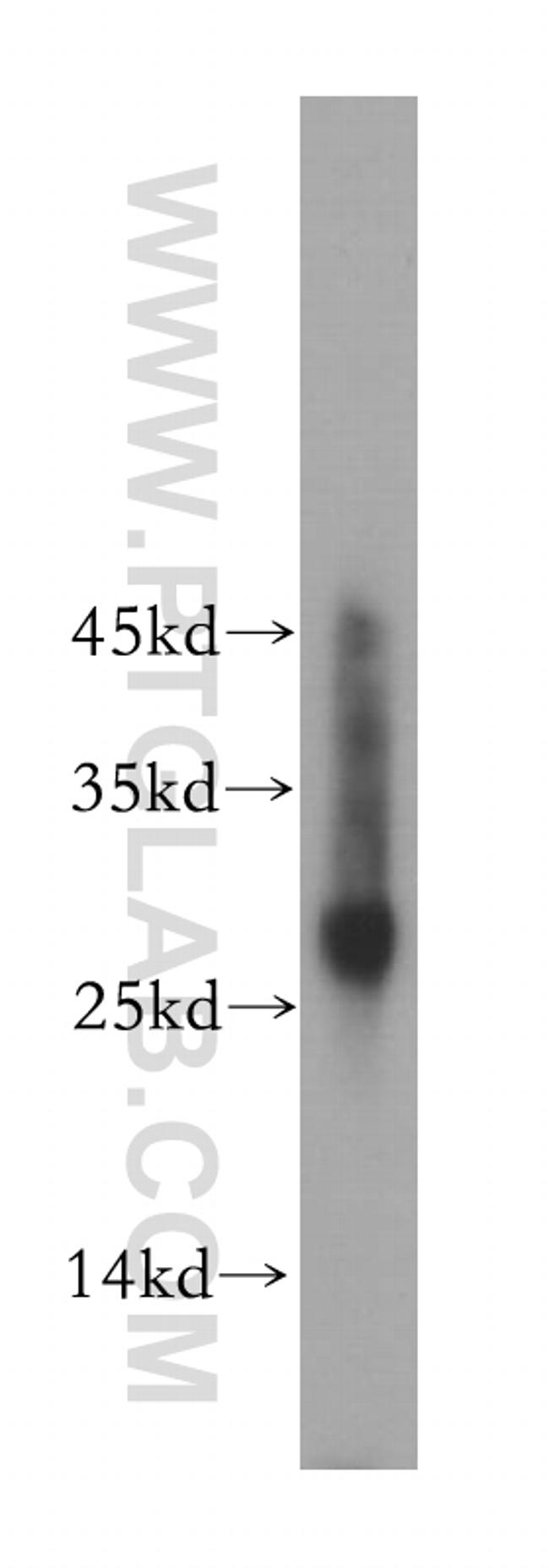 RAB27A Antibody in Western Blot (WB)