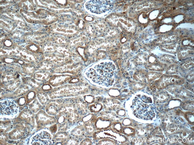 SNCAIP Antibody in Immunohistochemistry (Paraffin) (IHC (P))