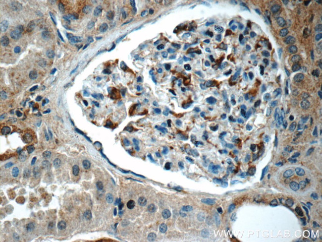 SNCAIP Antibody in Immunohistochemistry (Paraffin) (IHC (P))