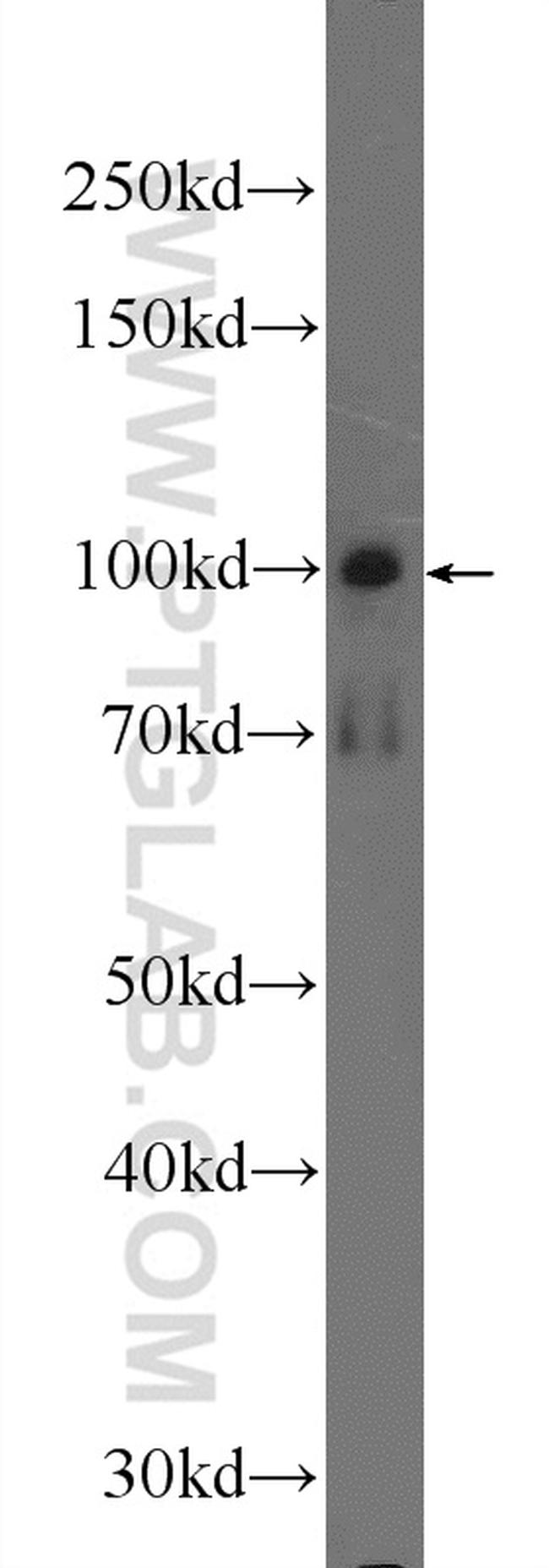 SNCAIP Antibody in Western Blot (WB)