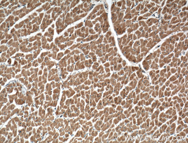 CACNA1G Antibody in Immunohistochemistry (Paraffin) (IHC (P))