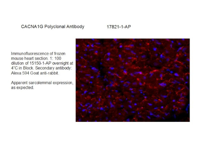 CACNA1G Antibody in Immunohistochemistry (Frozen) (IHC (F))