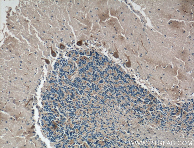 CACNA1G Antibody in Immunohistochemistry (Paraffin) (IHC (P))