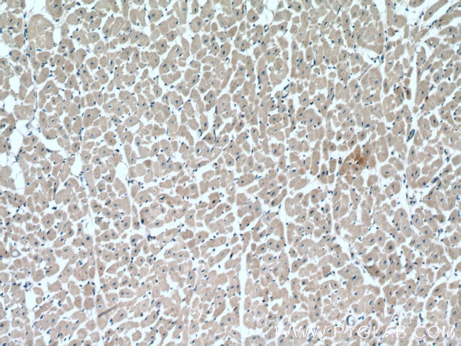 RAB1B Antibody in Immunohistochemistry (Paraffin) (IHC (P))