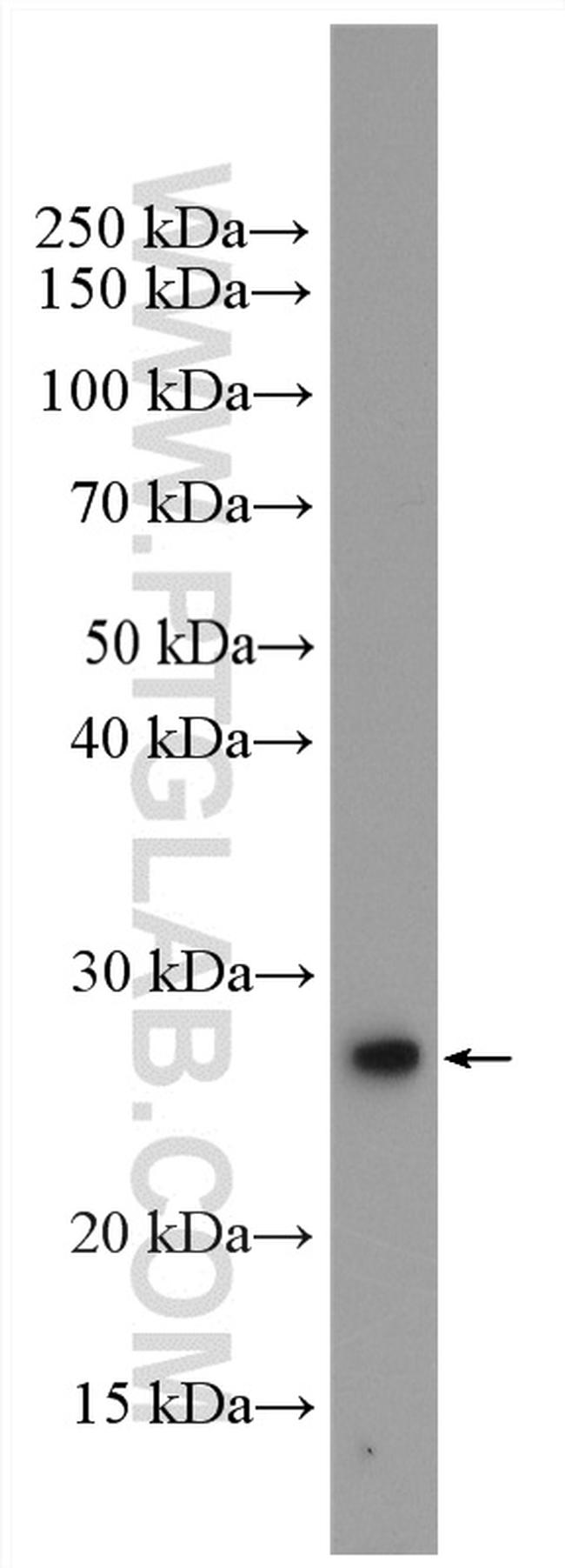 RAB1B Antibody in Western Blot (WB)