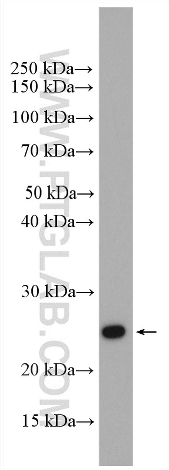 RAB1B Antibody in Western Blot (WB)