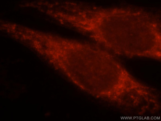 RAB3IL1 Antibody in Immunocytochemistry (ICC/IF)