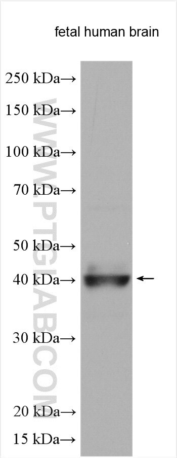 RAB3IL1 Antibody in Western Blot (WB)