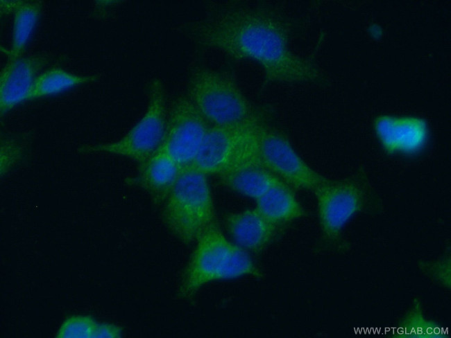 UCHL5IP Antibody in Immunocytochemistry (ICC/IF)