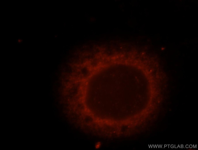 TNPO2 Antibody in Immunocytochemistry (ICC/IF)