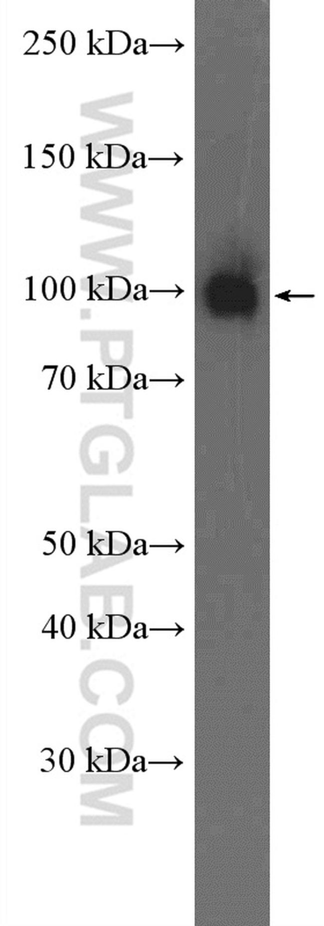 TNPO2 Antibody in Western Blot (WB)