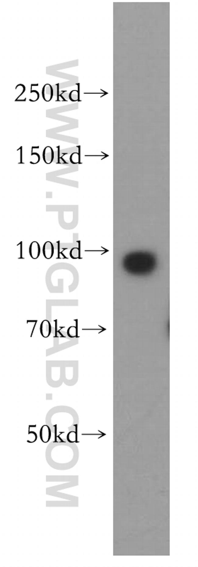 TNPO2 Antibody in Western Blot (WB)