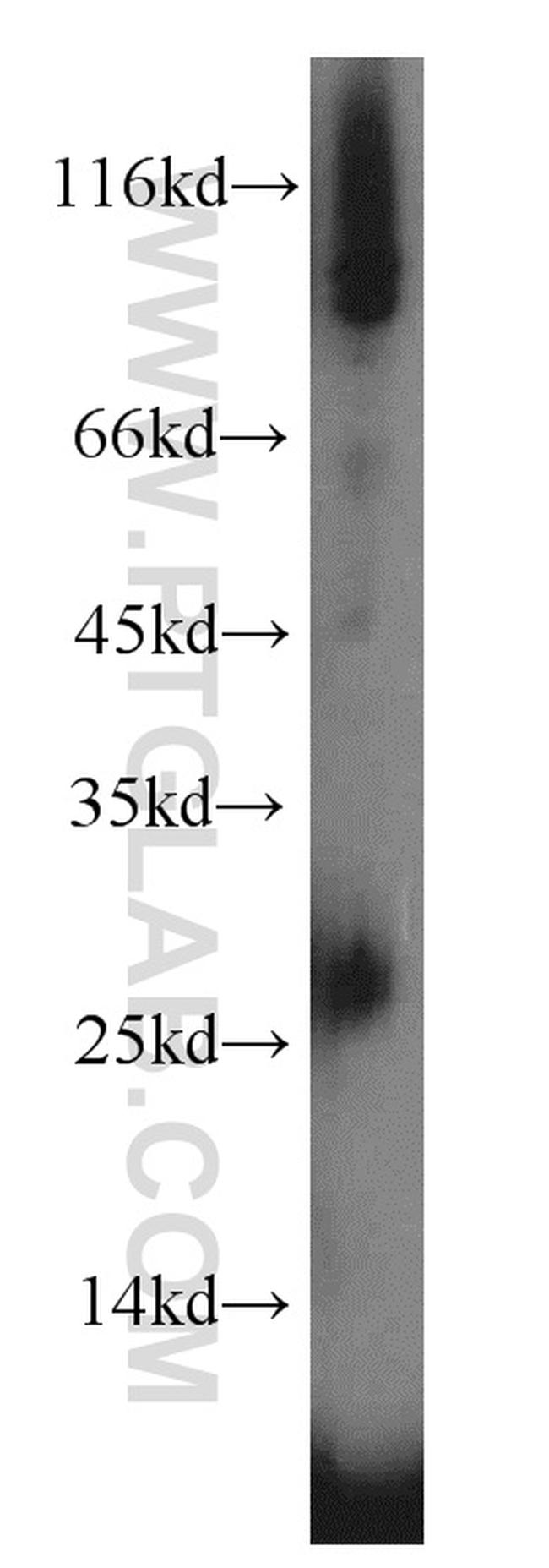 IL3 Antibody in Western Blot (WB)