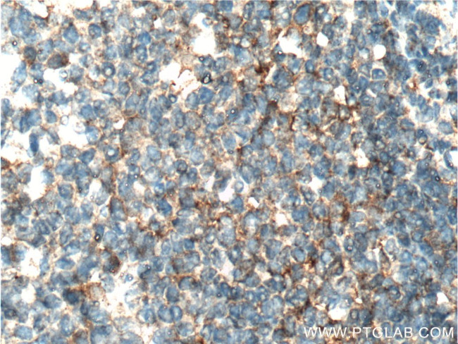 IL3 Antibody in Immunohistochemistry (Paraffin) (IHC (P))