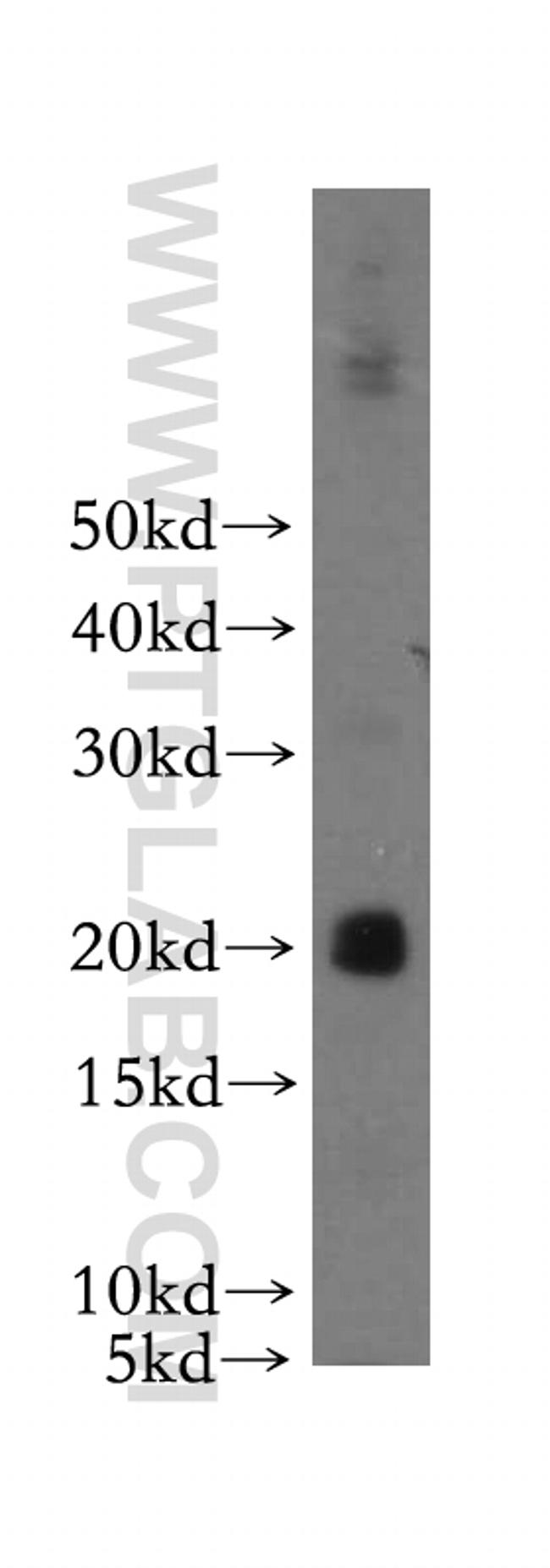 IL3 Antibody in Western Blot (WB)