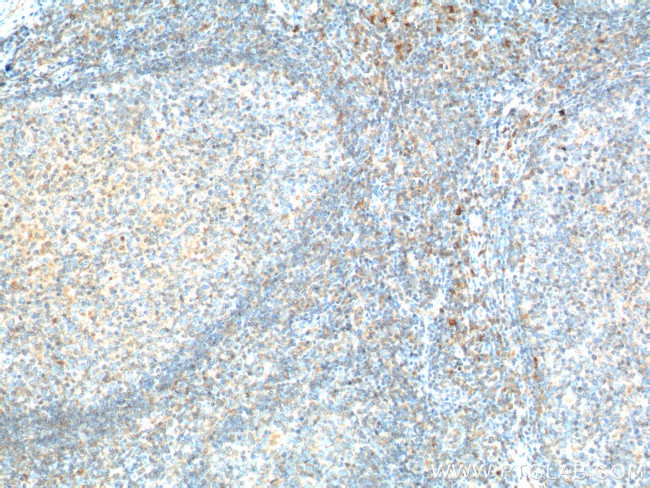 CD226 Antibody in Immunohistochemistry (Paraffin) (IHC (P))