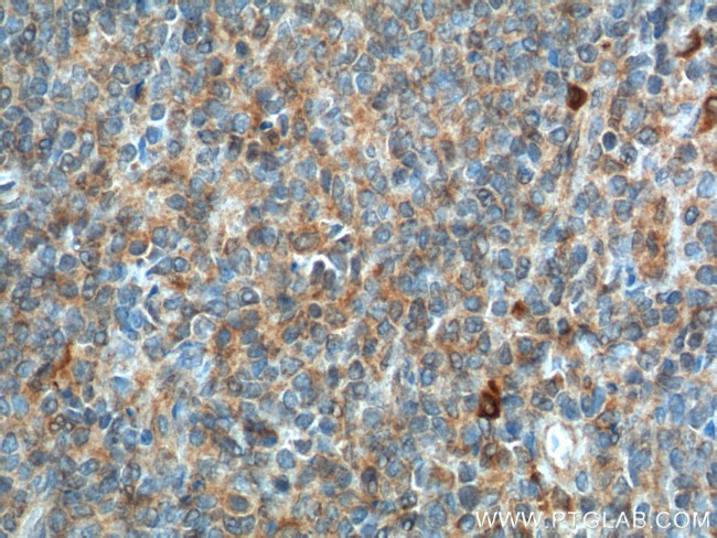 CD226 Antibody in Immunohistochemistry (Paraffin) (IHC (P))