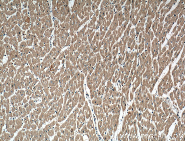 P2RX3 Antibody in Immunohistochemistry (Paraffin) (IHC (P))