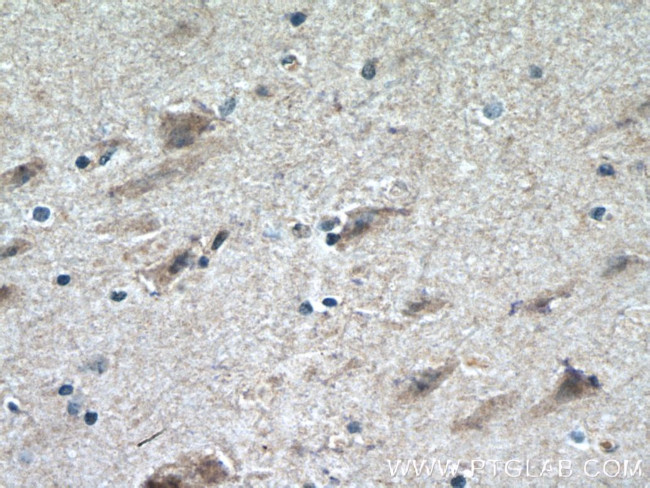 CHRNB2 Antibody in Immunohistochemistry (Paraffin) (IHC (P))