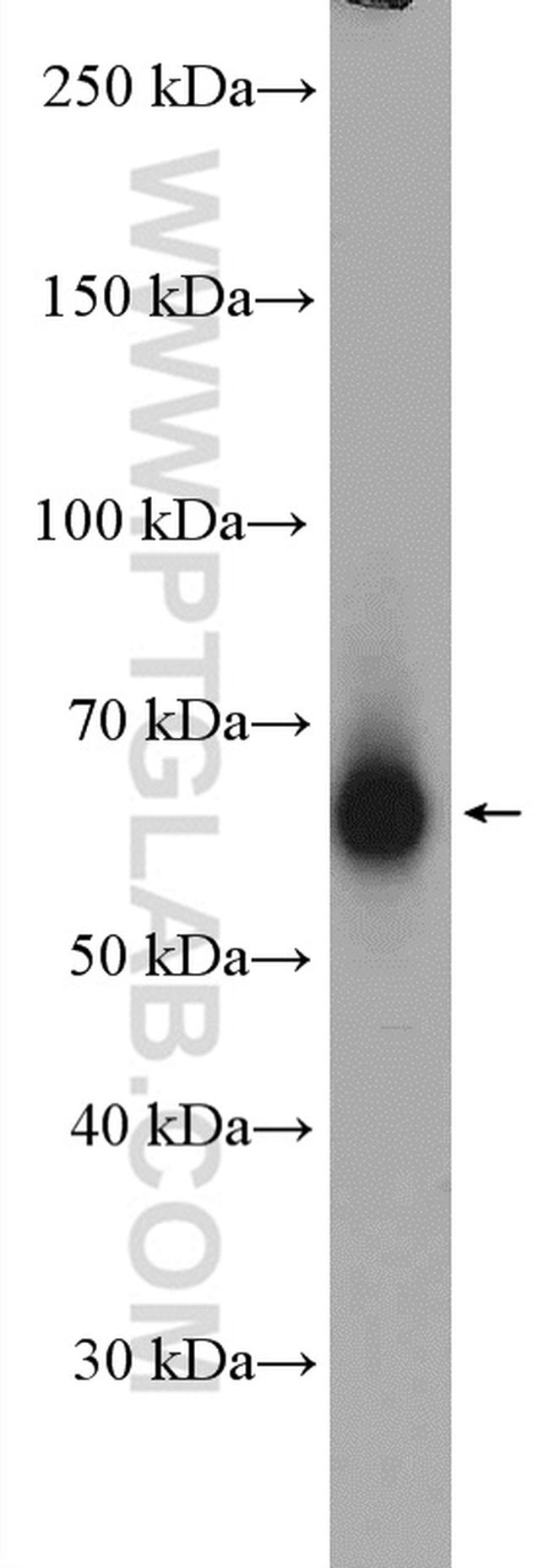 CHRNB2 Antibody in Western Blot (WB)