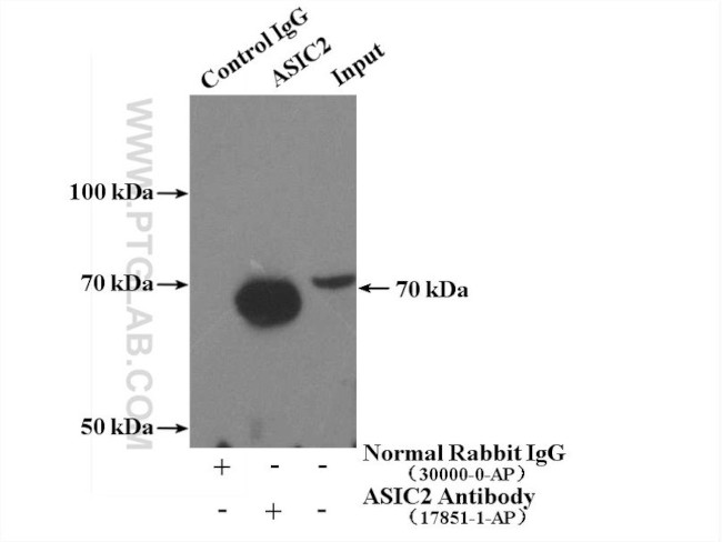 ASIC2 Antibody in Immunoprecipitation (IP)