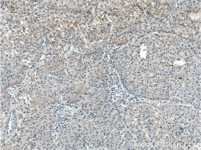 TNFSF8 Antibody in Immunohistochemistry (Paraffin) (IHC (P))