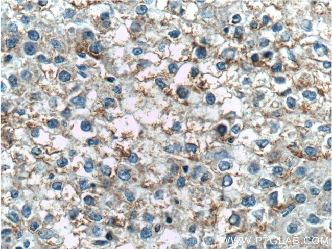 TNFSF8 Antibody in Immunohistochemistry (Paraffin) (IHC (P))