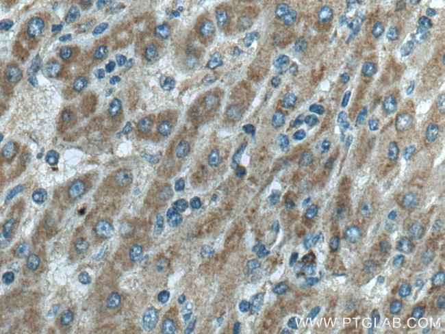 RFTN2 Antibody in Immunohistochemistry (Paraffin) (IHC (P))