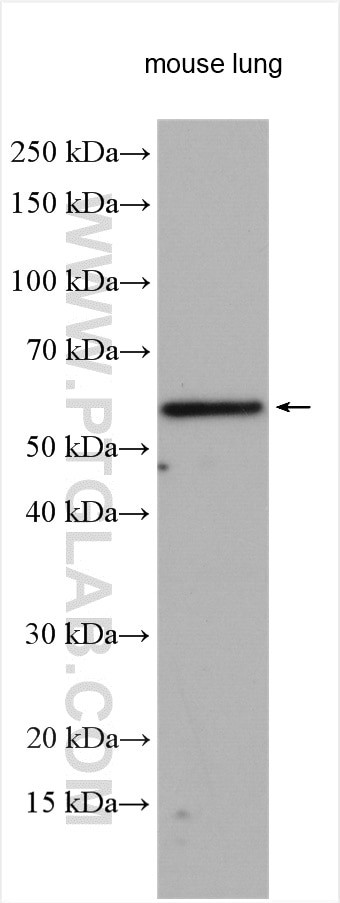 RFTN2 Antibody in Western Blot (WB)