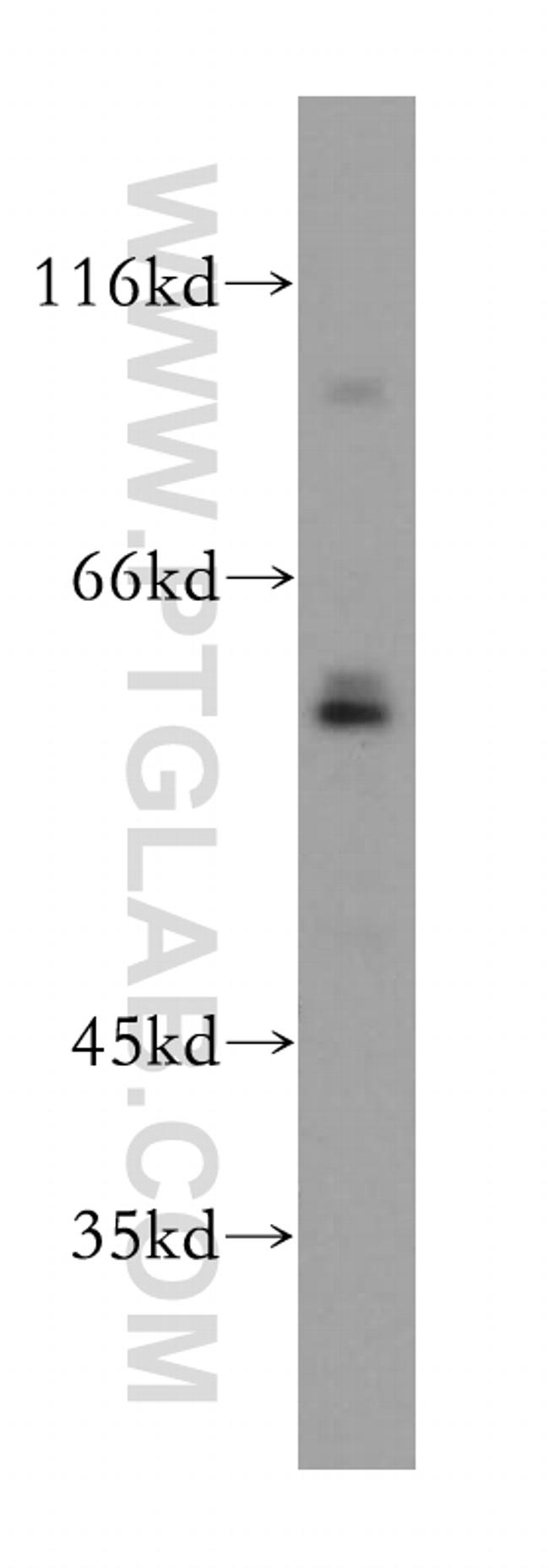 RFTN2 Antibody in Western Blot (WB)