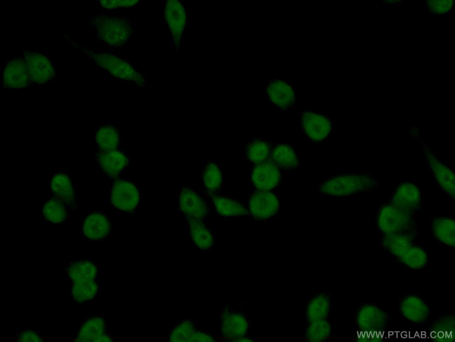 USP21 Antibody in Immunocytochemistry (ICC/IF)