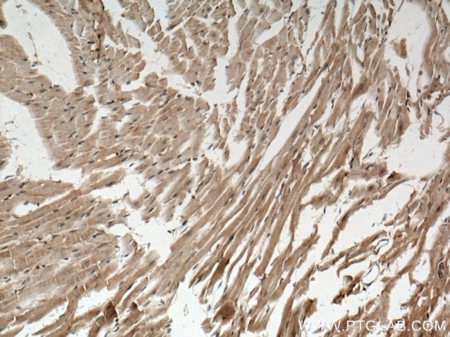 USP21 Antibody in Immunohistochemistry (Paraffin) (IHC (P))