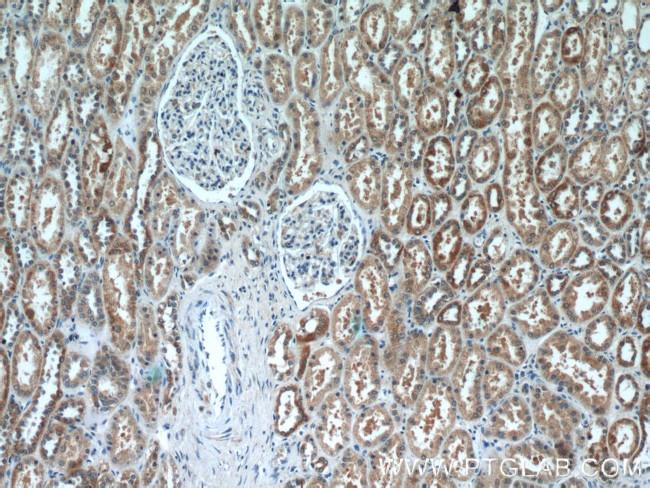 DDX10 Antibody in Immunohistochemistry (Paraffin) (IHC (P))