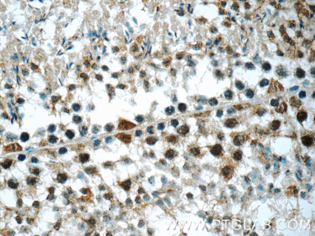 DDX10 Antibody in Immunohistochemistry (Paraffin) (IHC (P))