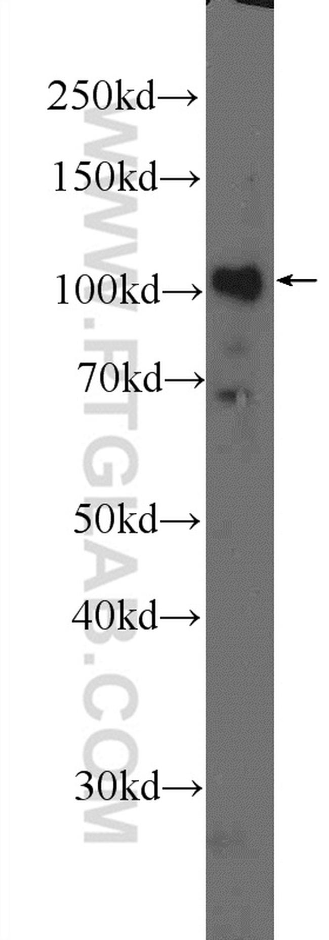 DDX10 Antibody in Western Blot (WB)