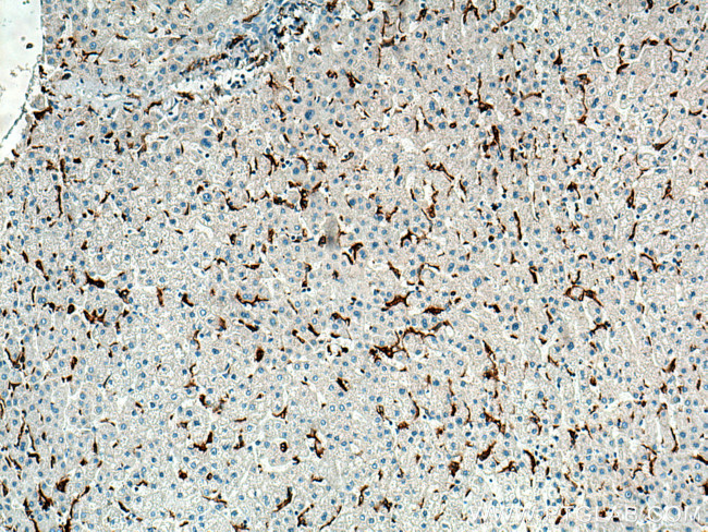 MSR1 Antibody in Immunohistochemistry (Paraffin) (IHC (P))