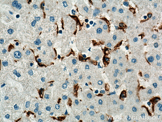 MSR1 Antibody in Immunohistochemistry (Paraffin) (IHC (P))