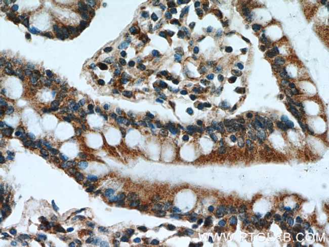 GCS1 Antibody in Immunohistochemistry (Paraffin) (IHC (P))