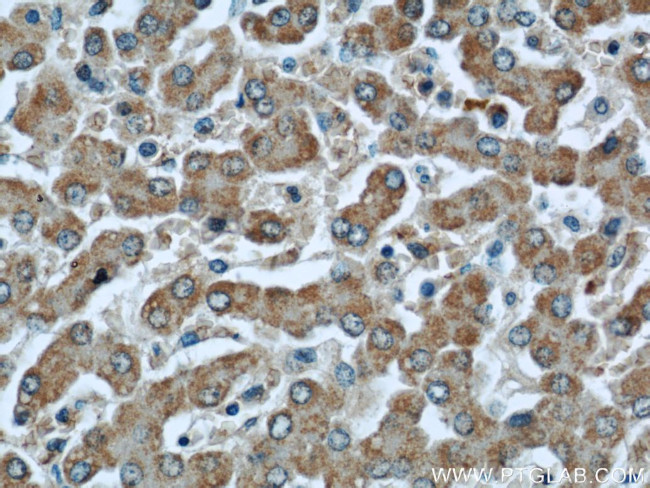 GCS1 Antibody in Immunohistochemistry (Paraffin) (IHC (P))