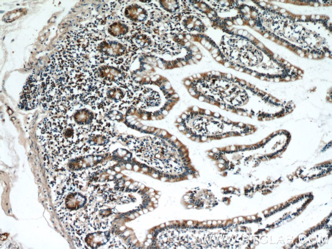 GCS1 Antibody in Immunohistochemistry (Paraffin) (IHC (P))