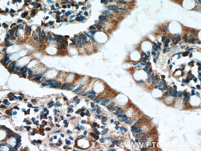 GCS1 Antibody in Immunohistochemistry (Paraffin) (IHC (P))