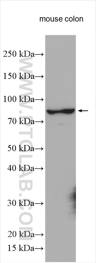 GCS1 Antibody in Western Blot (WB)