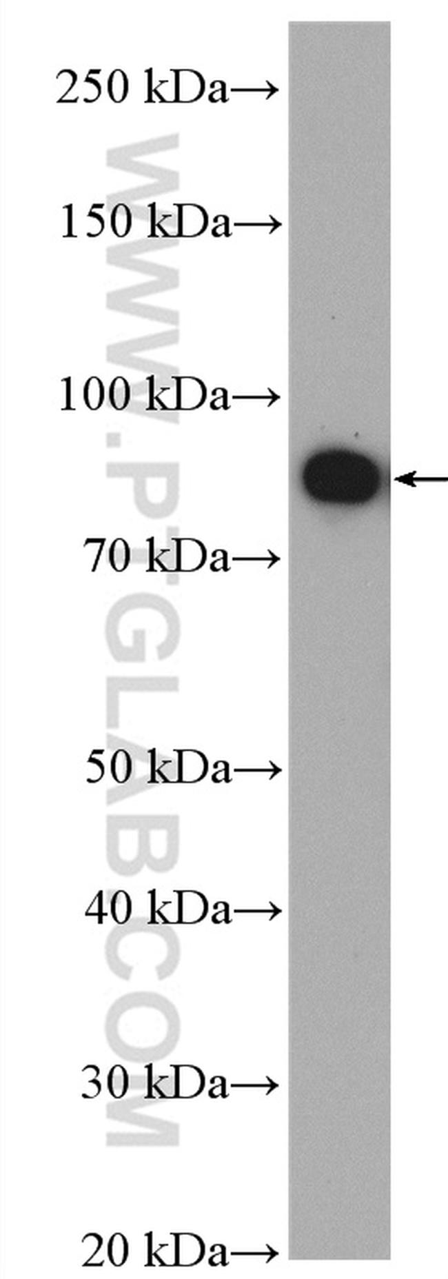 GCS1 Antibody in Western Blot (WB)