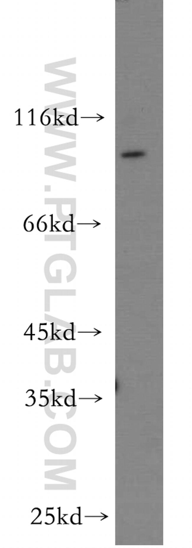 GCS1 Antibody in Western Blot (WB)