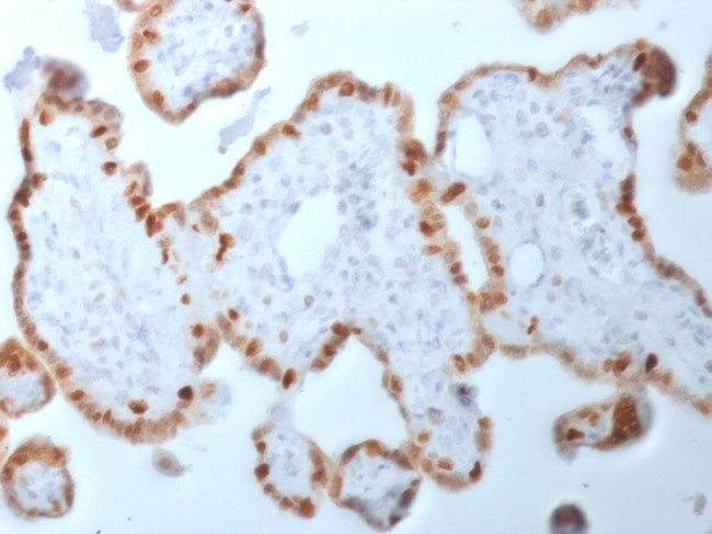 DNMT1/DNA Methyltransferase 1 Antibody in Immunohistochemistry (Paraffin) (IHC (P))